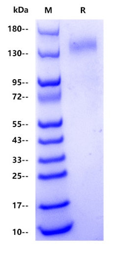 Human SPARCL1 Protein, His tag