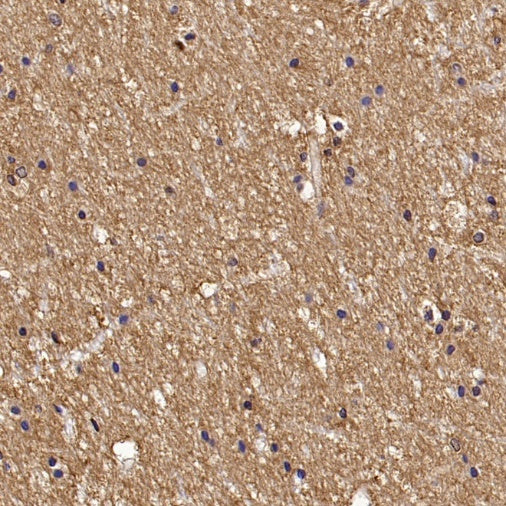 Versican Recombinant Rabbit mAb (S-3770-43)