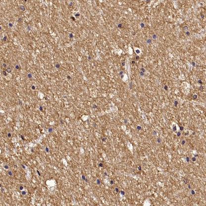 Versican Recombinant Rabbit mAb (S-3770-43)