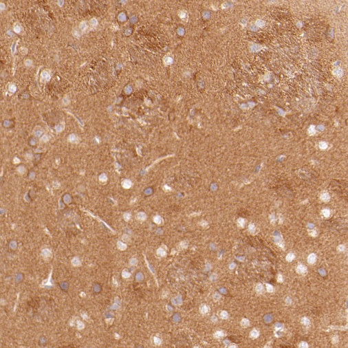 ART1 Recombinant Rabbit mAb (S-2396-1)