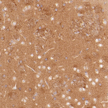 ART1 Recombinant Rabbit mAb (S-2396-1)