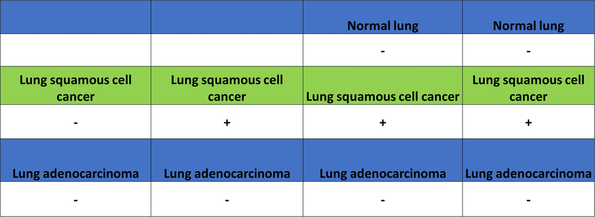 MAGE-A4 Recombinant Rabbit mAb (S-3868-66)