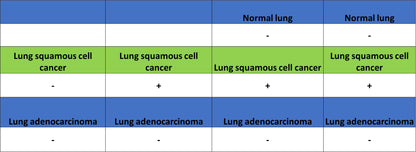MAGE-A4 Recombinant Rabbit mAb (S-3868-66)