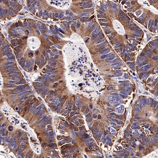 SQSTM1/p62 Recombinant Rabbit mAb (S-R346)