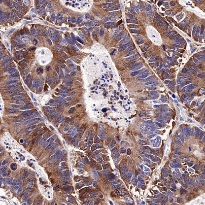 SQSTM1/p62 Recombinant Rabbit mAb (S-R346)