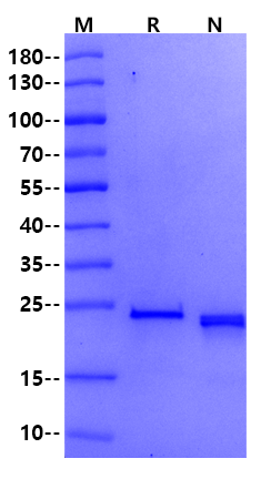 KRAS(G12V) His Tag Protein, Human