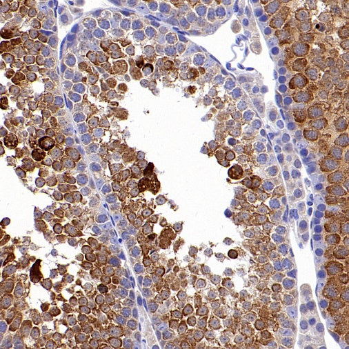 HSP70 Recombinant Rabbit mAb (S-992-39)