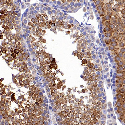 HSP70 Recombinant Rabbit mAb (S-992-39)
