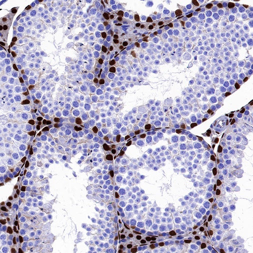 GATA4 Recombinant Rabbit mAb (S-1428-141)