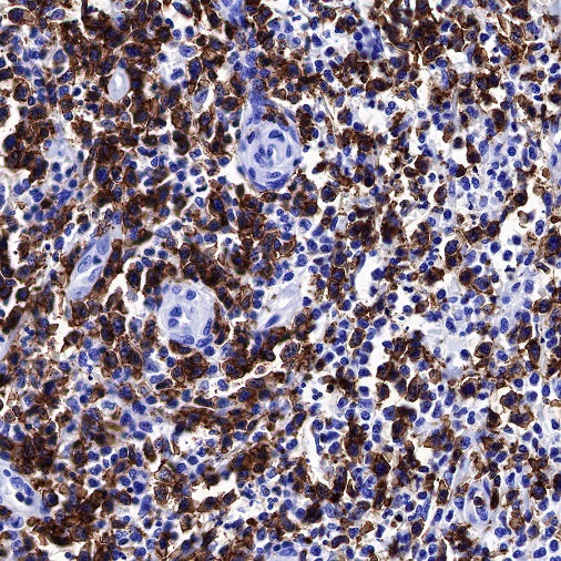 CD6 Mouse mAb (S-688-33)
