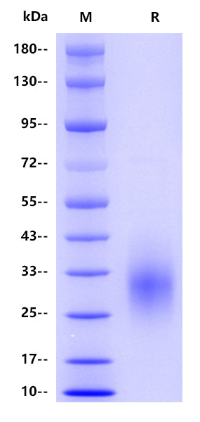 BTLA/CD272 His Tag Protein, Human