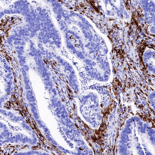 HLA-DP alpha1 Recombinant Rabbit mAb (S-R243)