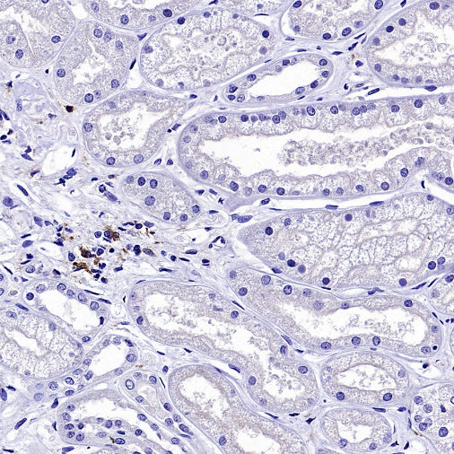 VSIG4 Recombinant Rabbit mAb (SDT-2737-61)