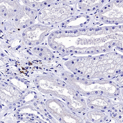 VSIG4 Recombinant Rabbit mAb (SDT-2737-61)