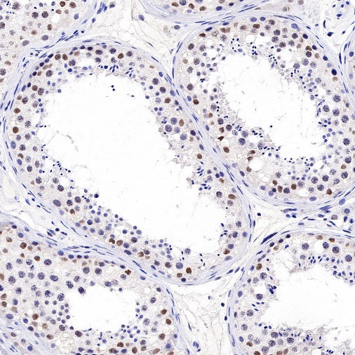 Topoisomerase I/TOP1 Recombinant Rabbit mAb (S-822-60)