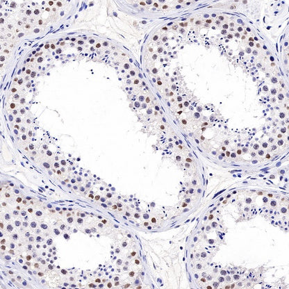 Topoisomerase I/TOP1 Recombinant Rabbit mAb (S-822-60)