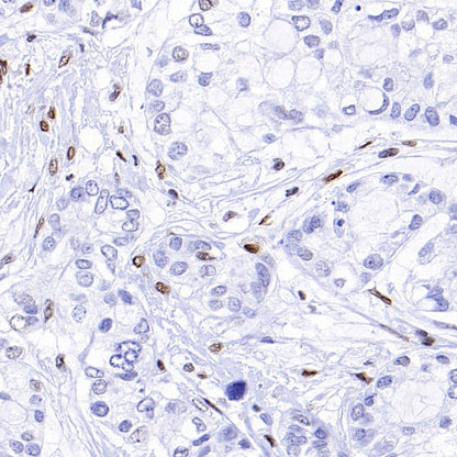 Runx2 Recombinant Rabbit mAb (S-1767-173)