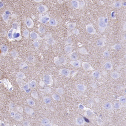 Phospho-α-Synuclein (Ser129) Recombinant Rabbit mAb (SDT-3397)