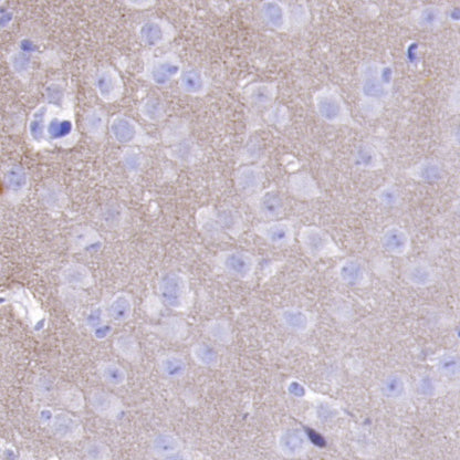 Phospho-α-Synuclein (Ser129) Recombinant Rabbit mAb (SDT-3397)