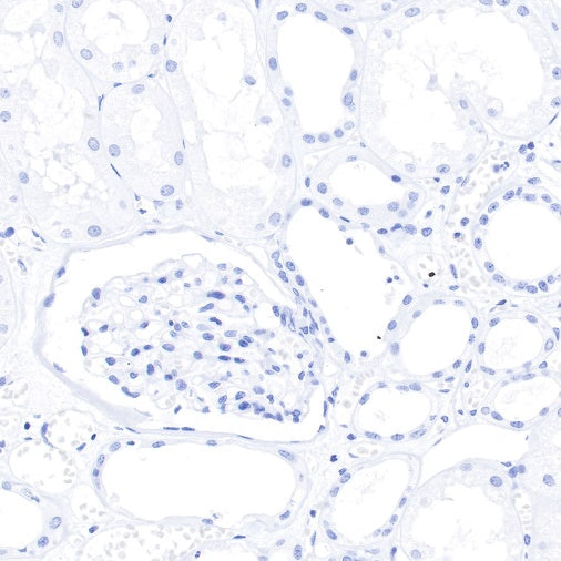 S-RMab® GCDFP-15 Recombinant Rabbit mAb (SDT-R030)