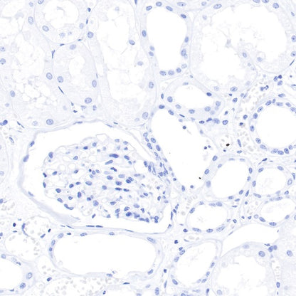 S-RMab® GCDFP-15 Recombinant Rabbit mAb (SDT-R030)