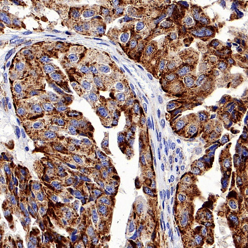 LAMP1 Recombinant Rabbit mAb (S-952-18)