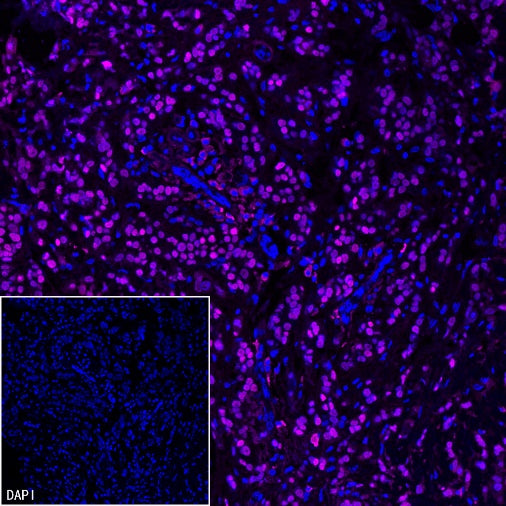 FOXA1 Recombinant Rabbit mAb, PBS Only  (SDT-2779-17)