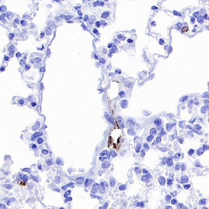 CCL21 Recombinant Rabbit mAb (S-3198-156)
