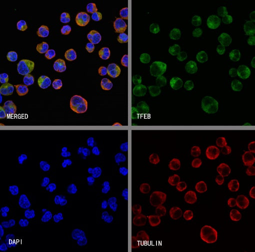 TFEB Recombinant Rabbit mAb,PBS Only (SDT-2411-7)