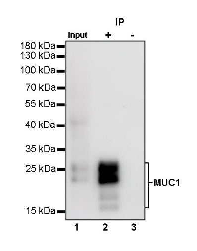 MUC1/EMA Mouse mAb (SDT-777-37)