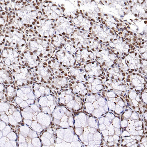 RNF40 Recombinant Rabbit mAb (S-1068-279)