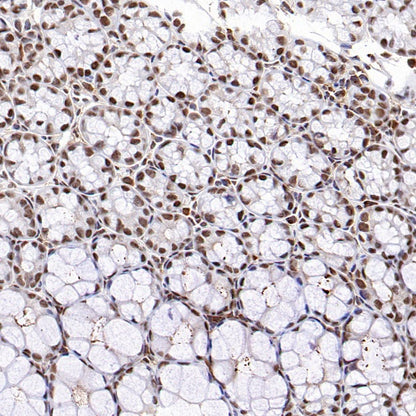 RNF40 Recombinant Rabbit mAb (S-1068-279)