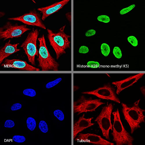 Histone H2B (mono methyl K5) Recombinant Rabbit mAb (S-1416-412)