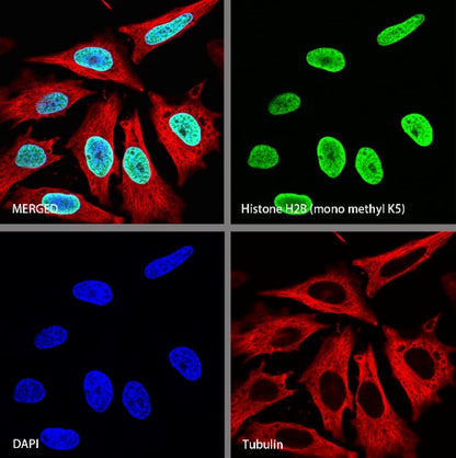 Histone H2B (mono methyl K5) Recombinant Rabbit mAb (S-1416-412)