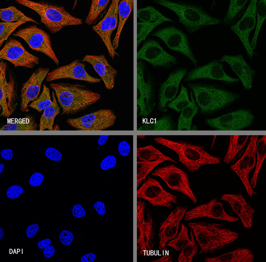 KLC1 Recombinant Rabbit mAb (S-4556-8)