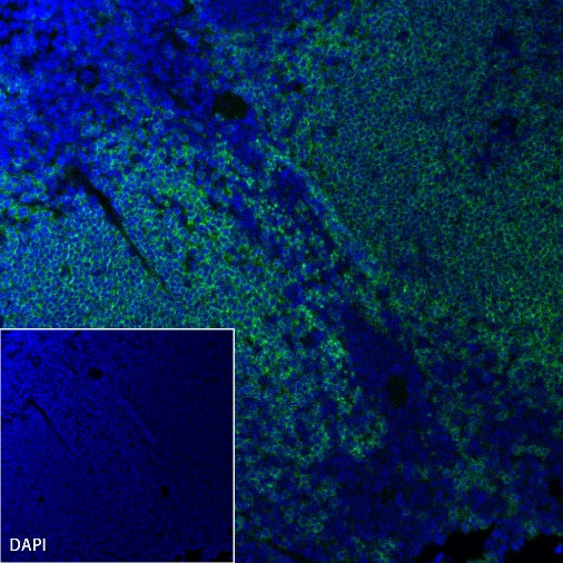 CD19 Recombinant Rabbit mAb (S-3357)
