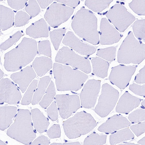 CD25/IL-2Rα Recombinant Rabbit mAb (S-R223)