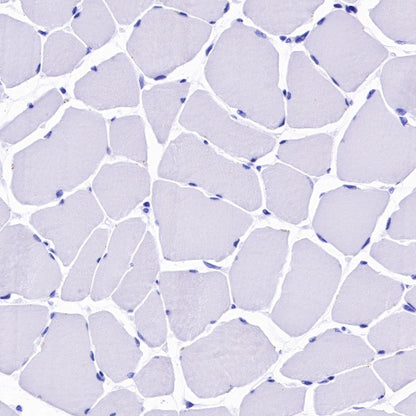 CD25/IL-2Rα Recombinant Rabbit mAb (S-R223)