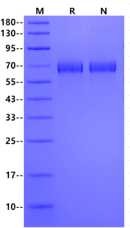 Cathepsin F His Tag Protein, Human