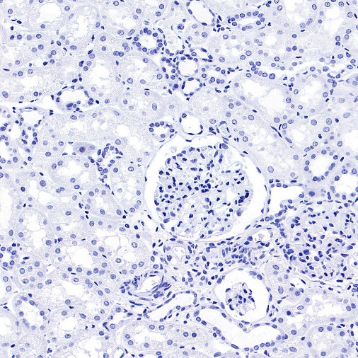 Brachyury Recombinant Rabbit mAb (SDT-1926-107)