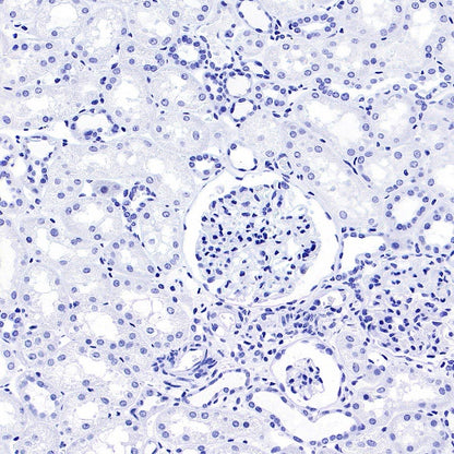 Brachyury Recombinant Rabbit mAb (SDT-1926-107)