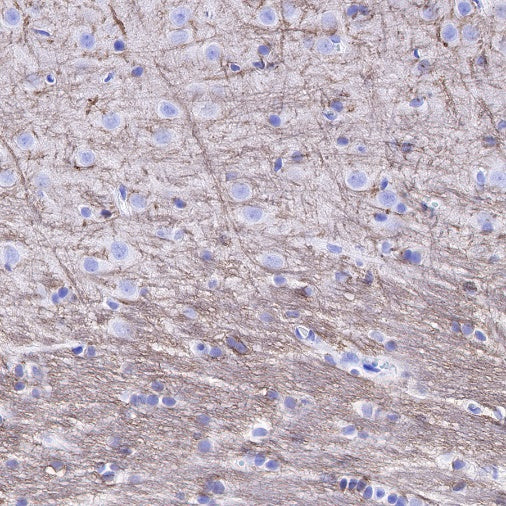 Myelin Basic Protein Recombinant Rabbit mAb (S-582-79)