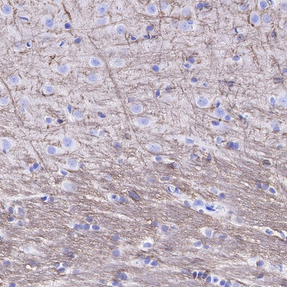 Myelin Basic Protein Recombinant Rabbit mAb (S-582-79)