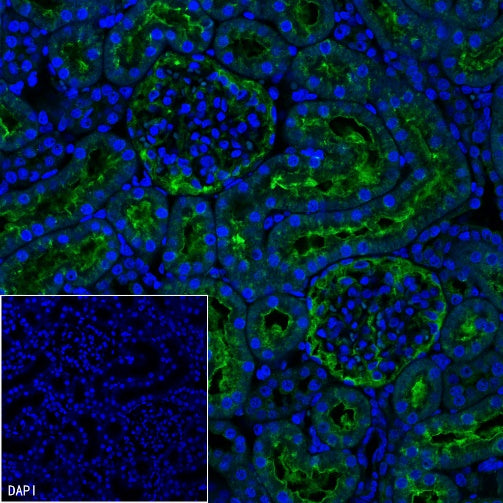 CBS Rabbit Polyclonal Antibody