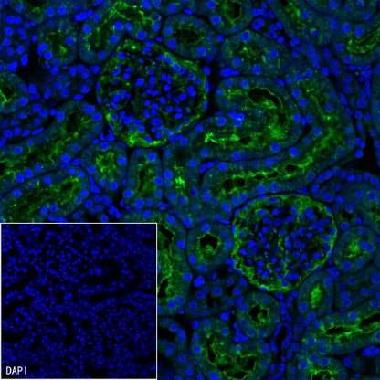 CBS Rabbit Polyclonal Antibody