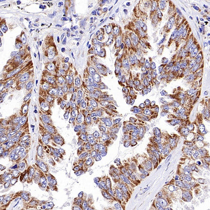 SLC25A22 Recombinant Rabbit mAb (S-2780-15)