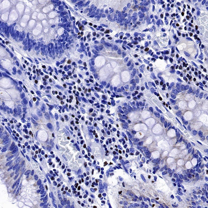 AiolosI/KZF3 Recombinant Rabbit mAb (S-1268-42)