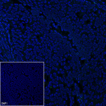 Brachyury Recombinant Rabbit mAb (SDT-1926-107)