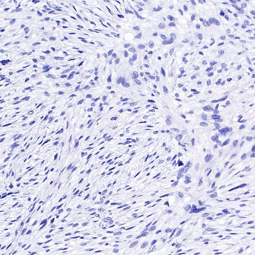 Brachyury Recombinant Rabbit mAb (SDT-1926-107)