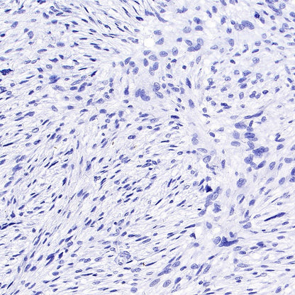 Brachyury Recombinant Rabbit mAb (SDT-1926-107)